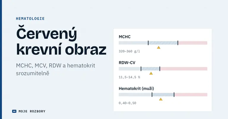Titulní grafika článku o červeném krevním obrazu s orientačními pásmy MCHC, RDW-CV a hematokritu