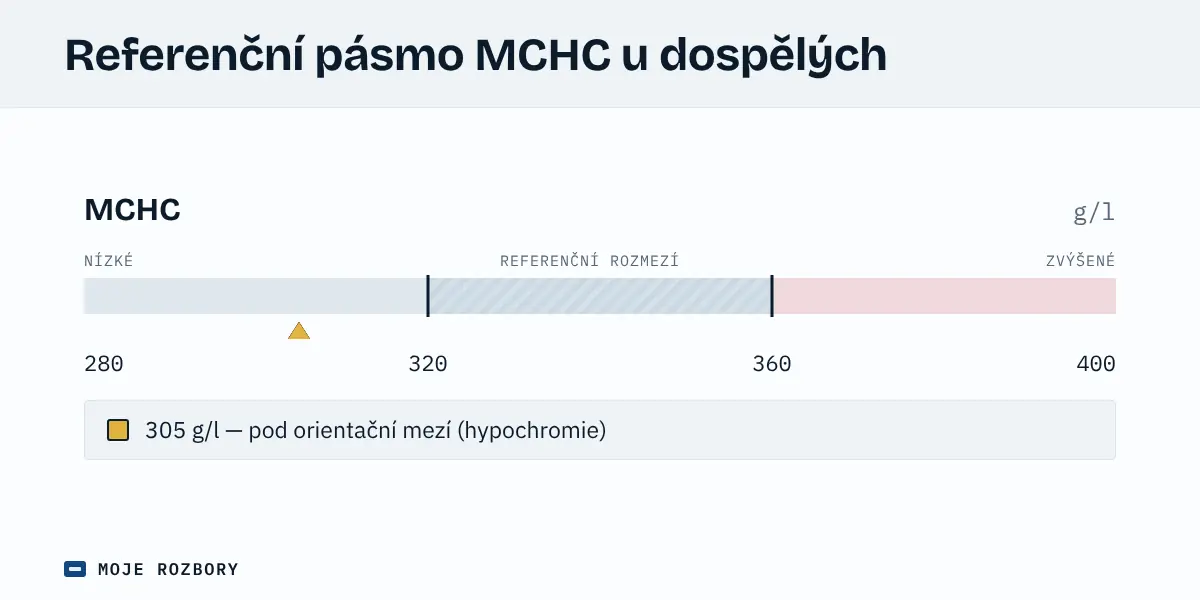 Grafické znázornění orientačního referenčního pásma MCHC u dospělých s vyznačenou sníženou hodnotou 305 g/l