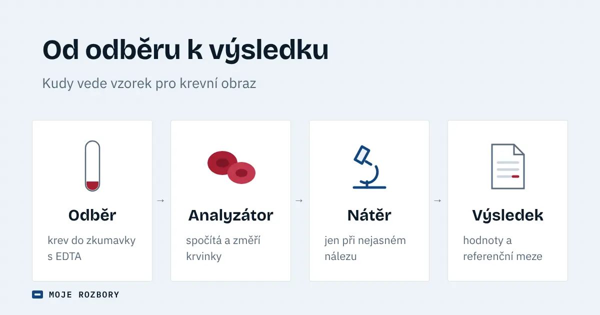 Schéma cesty vzorku pro krevní obraz od odběru do zkumavky s EDTA přes analyzátor a mikroskopický nátěr k výsledkovému listu
