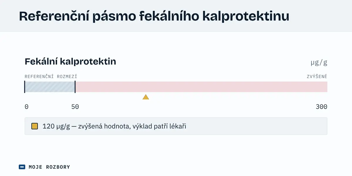 Grafické znázornění orientačního referenčního pásma fekálního kalprotektinu pod 50 µg/g s vyznačenou zvýšenou hodnotou 120 µg/g