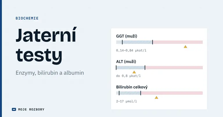 Titulní grafika článku o jaterních testech s orientačními pásmy GGT, ALT a celkového bilirubinu