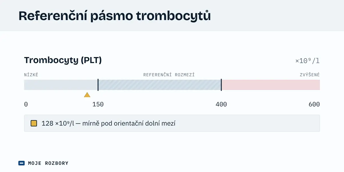 Referenční pásmo počtu trombocytů od 150 do 400 ×10⁹/l na ose od 0 do 600 s vyznačenou hodnotou 128 ×10⁹/l mírně pod dolní mezí