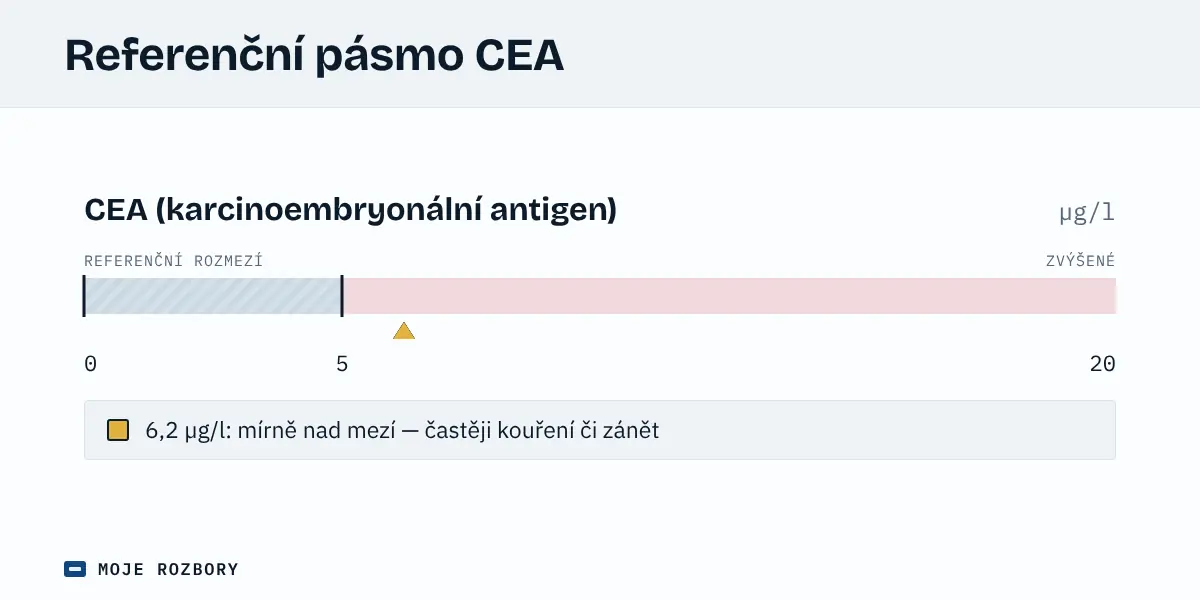 Grafické znázornění orientačního referenčního pásma CEA od 0 do 5 µg/l s vyznačenou hodnotou 6,2 µg/l mírně nad horní mezí